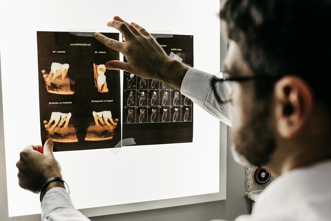 Man looking at x-rays of teeth